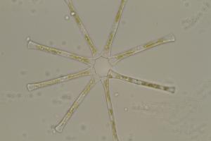 Asterionella spec. Kieselalge aus dem Phytoplankton